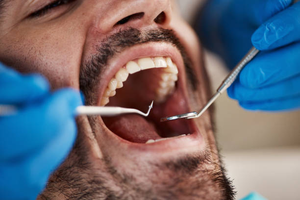 Best Dentist for Tooth Abscess  in Fiskdale, MA